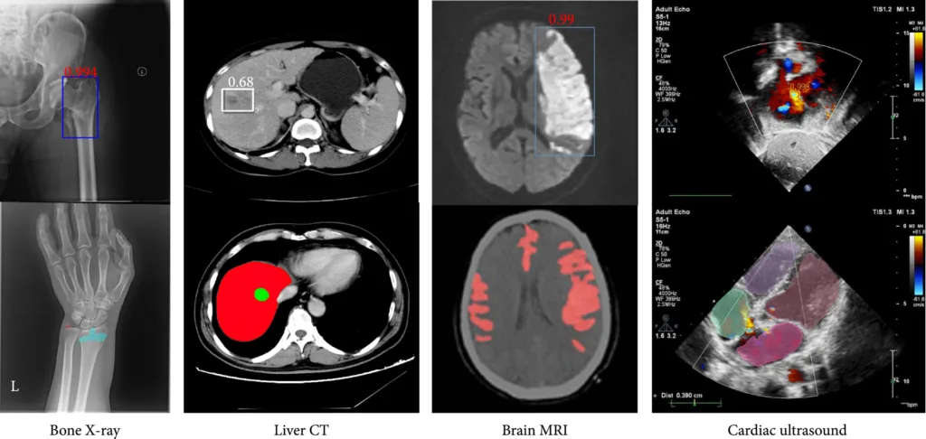 Tren Penelitian Deep Learning pada Citra Medis